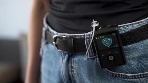 Appy Medical - Diabetes Insulin Pump